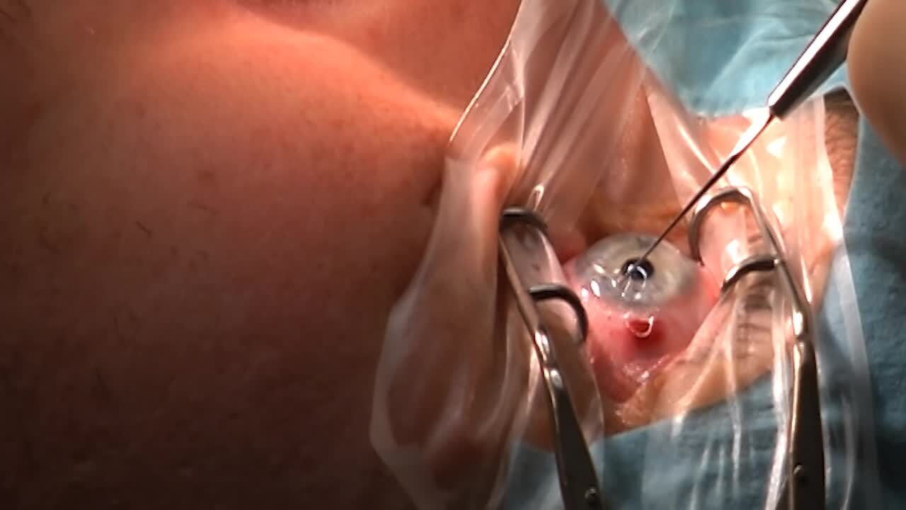 Lasik Logo